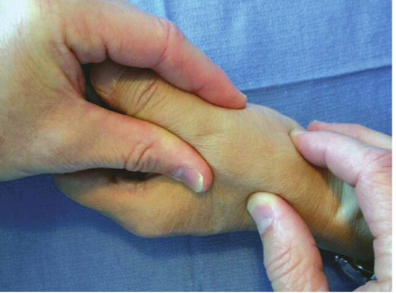 rizartroza palca na ruke medicamente pentru tratamentul durerilor de șold
